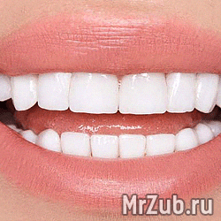 Emax и цирконевые коронки в Новогиреево